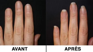 10 façons rapides de faire pousser ses ongles