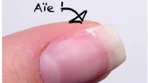 Comment réparer un ongle cassé naturellement