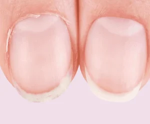 10 façons de faire disparaître les stries sur les ongles 1