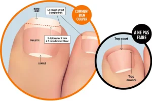Comment bien se couper les ongles des pieds