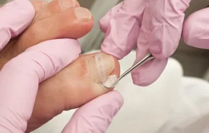 Comment couper un ongle en volute sans risque 1