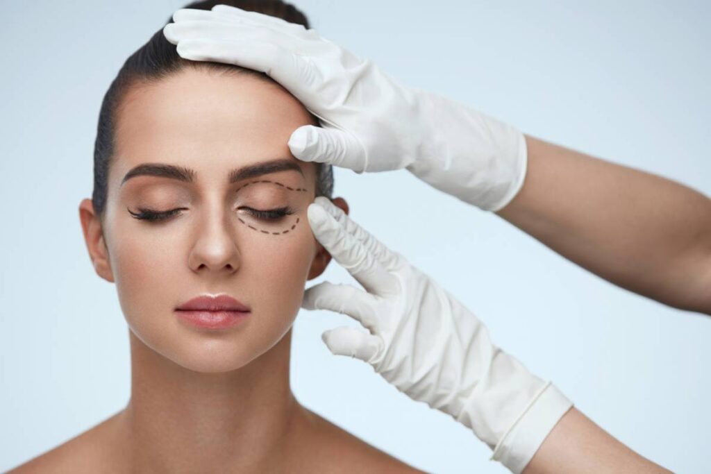 blepharoplastie paupieres