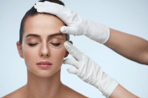 blepharoplastie paupieres